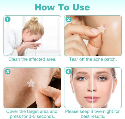 Pimple Patches，Star Grain Patches