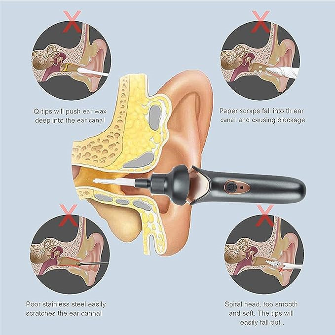 🔥Hot Sale🔥 Earwax Vacuum – Safe & Painless Ear Cleaning for the Whole Family