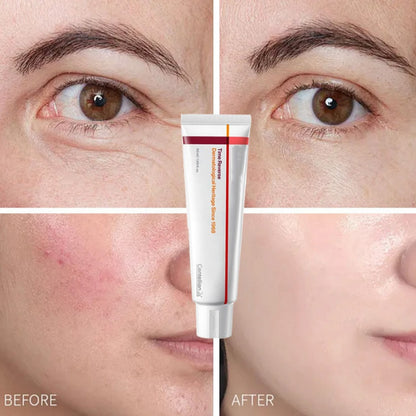 🎁Today's Specials💥Hydrating and moisturizing acne-fighting face cream 50ml