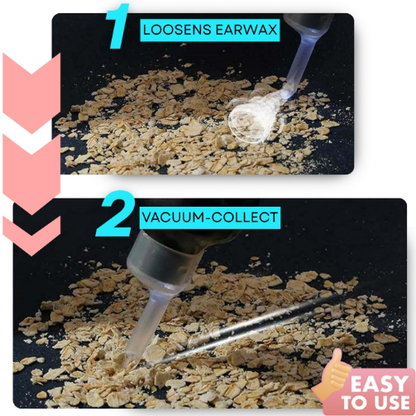 🔥Hot Sale🔥 Earwax Vacuum – Safe & Painless Ear Cleaning for the Whole Family